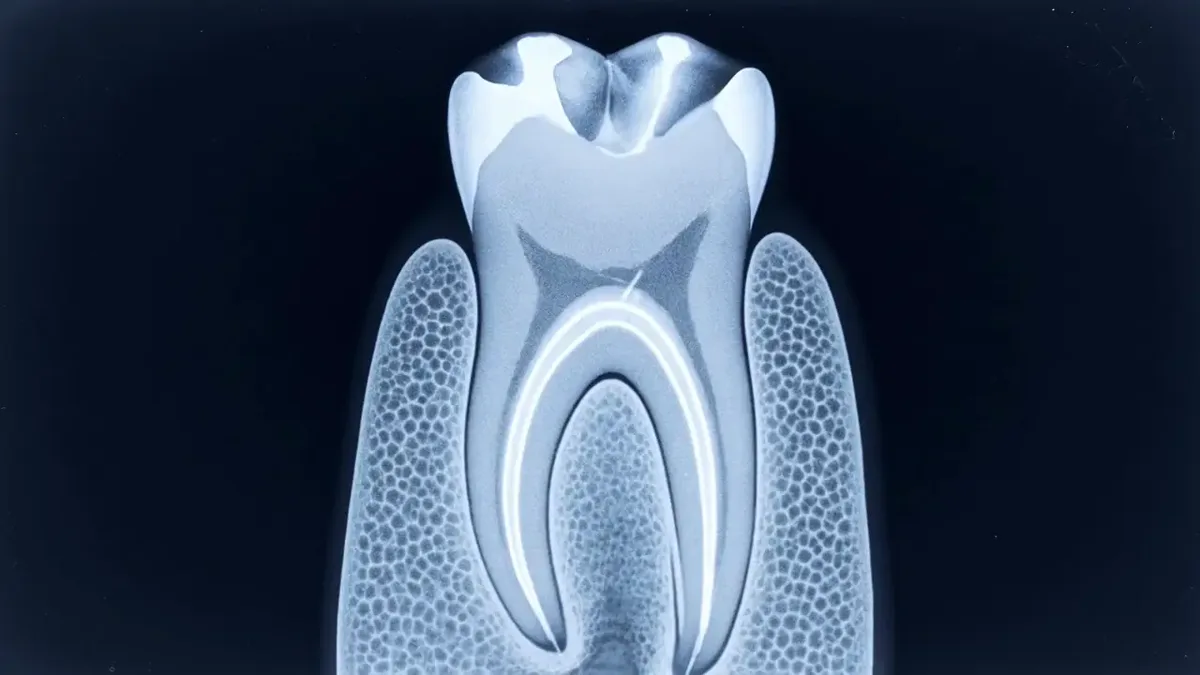 A scanning line crossing a dental radiograph, teeth and roots lit as it passes